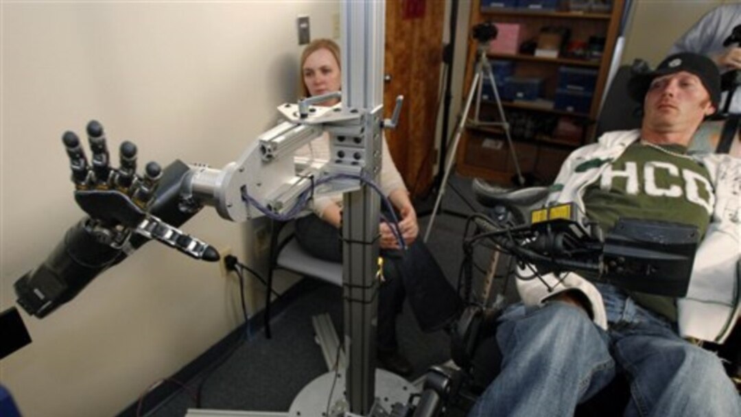 Robot Prostetik: Solusi Modern Untuk Kebutuhan Rehabilitasi 2025